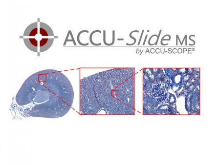 Accu-Scope ACCU-SlideMS Manual Slide Scanning System For Cheap